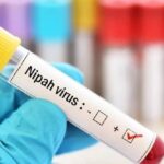 Nipah Virus (NiV): Essential Facts, Symptoms, and Safety Measures