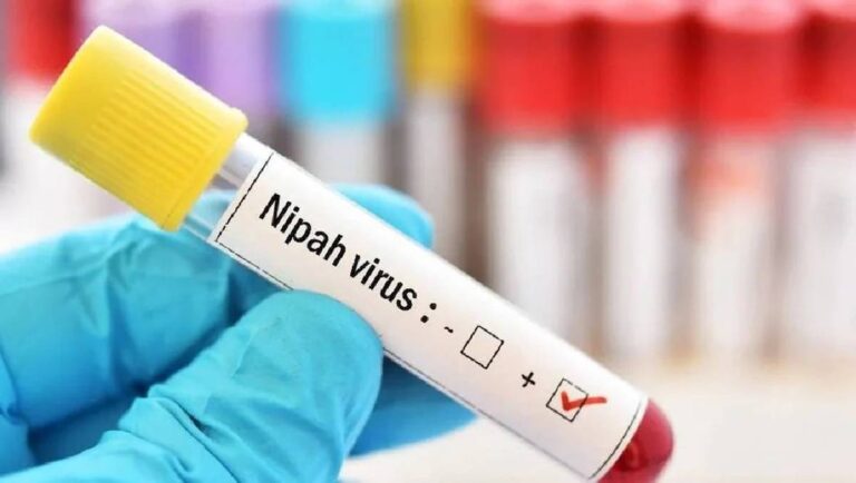 Nipah Virus (NiV): Essential Facts, Symptoms, and Safety Measures